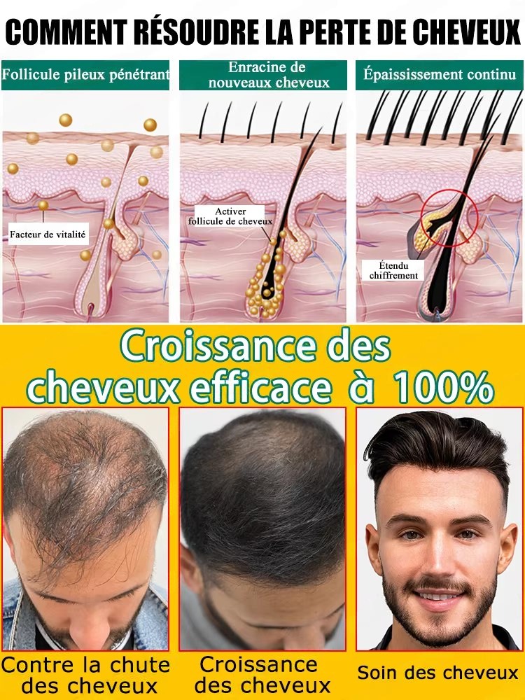 Natural Ginger Hair Care Essen - Hair Care For Hair Fall recension och pris